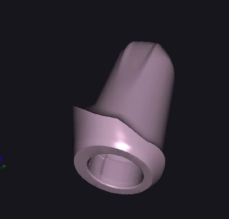 STL - Implante Dental render 3