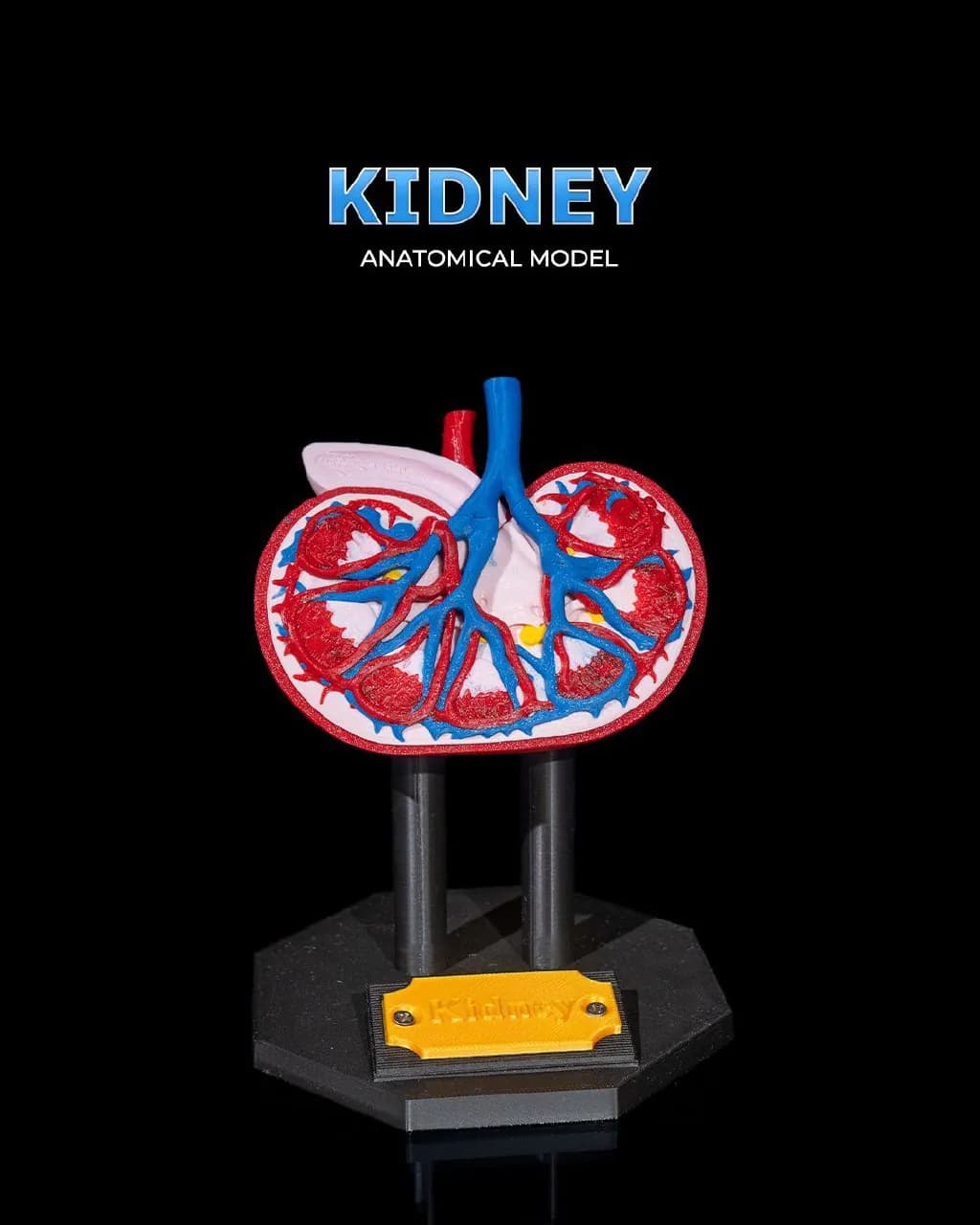 STL - Modelo Anatómico de Riñón