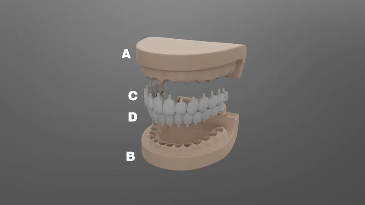STL - Modelo de dentadura completa