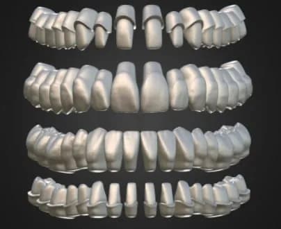 STL - Modelo de dientes 3D