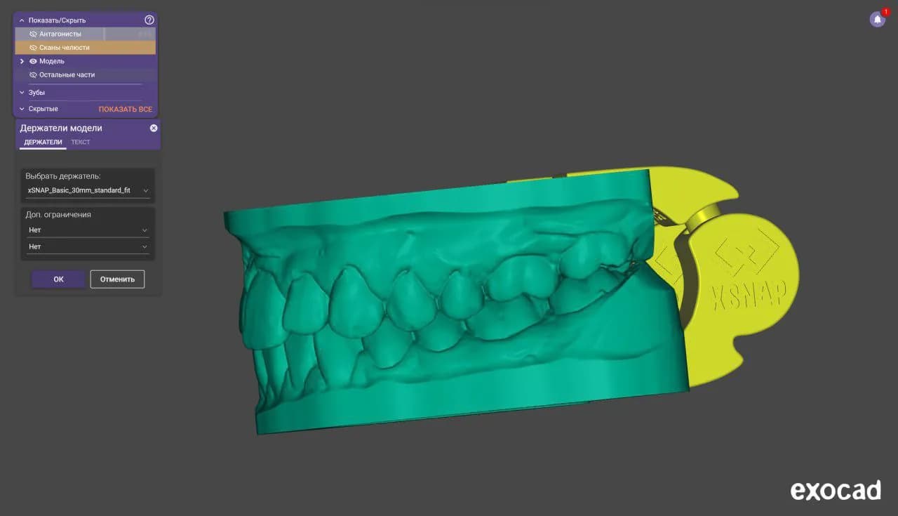 STL - Modelo dental con sujetador XSNAP