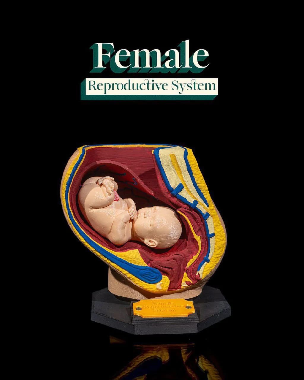 STL - Sistema Reproductor Femenino